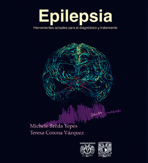 Epilepsia: herramientas actuales para el diagnóstico y tratamiento